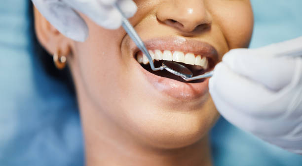 Best Weekend Emergency Dental Services in Palm City, FL