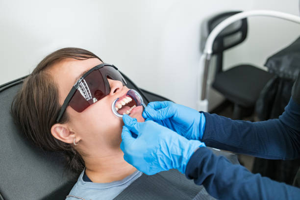 Best Knocked-Out Tooth (Avulsed Tooth) Treatment in Palm City, FL